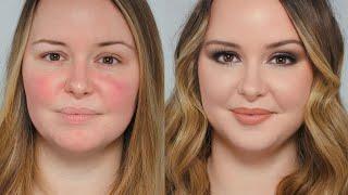 I do a Subscribers Make Up! Rosacea, Sensitive Skin and the Power of Make Up