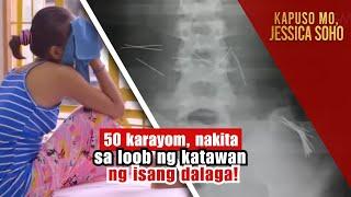 50 karayom, nakita sa loob ng katawan ng isang dalaga! | Kapuso Mo, Jessica Soho