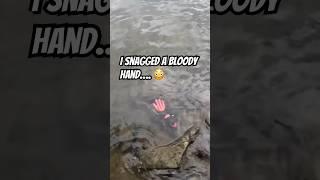 I Snagged a Bloody Hand Fishing…..  #shorts #fishing #ohno