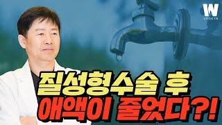 질건조증 위험을 높이는 질성형수술?! 질점막의 중요성!