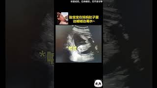 超聲記錄6個月大的胎寶寶邊噓噓邊喝水，網友1：神奇的生命是這樣的！網友2：別在那傻樂了，你在肚子裡的時候也一樣~（科普紀實，僅供娛樂，無不良引導）#shorts #DynamicChina