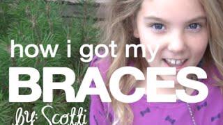 How I Got My Braces - by:Scotti