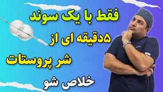 جدیدترین تکنولوژی درمان بزرگی خوش خیم پروستات بنام اپتیلوم