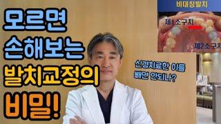 발치교정 의 비밀! 모르면 손해!