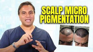 What is Scalp Micro pigmentation? | The Hair Loss Show