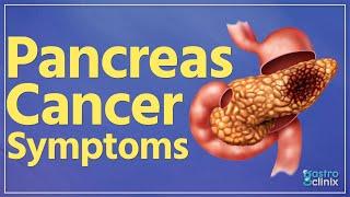 What are the symptoms of pancreas cancer ?