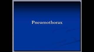 Chest Xray : Pneumothorax ( by hammadshams )