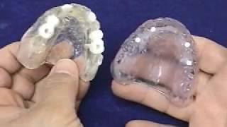 Radiographic and Surgical Implant Templates for the Completely Edentulous: Fabrication Technique