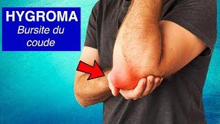 Bursite du coude (Hygroma) : Symptômes, diagnostic et traitements