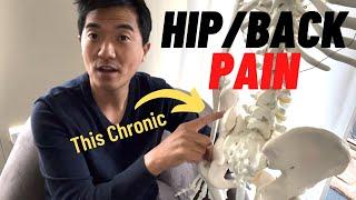 This Annoying & Chronic Hip & Back Pain | How to Fix it Properly 