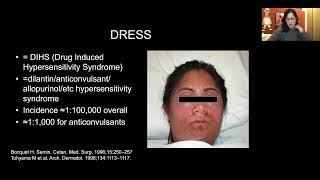 Drug Reactions with Eosinophilia and Systemic Symptoms (DRESS): A Dermatologist’s Perspective