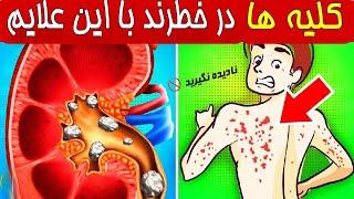 هشداراگر این علایم را دارید فورا به پزشک مراجعه کنید خطر نارسایی کلیه وجود دارد