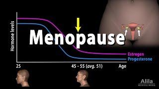 Menopause, Perimenopause, Symptoms and Management, Animation.