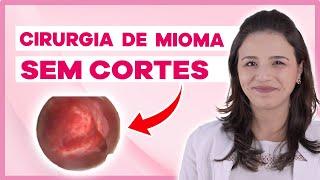 Mioma Submucoso: Tudo o que você precisa saber (Vídeo com cirurgia)