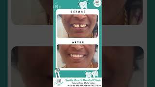 Smile Kochi Dental Clinic | Kadavanthara | PalarivattomSmile Kochi Dental Clinic