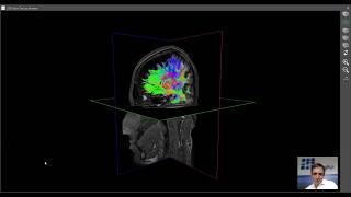 Brain Mysteries - 2. The Brain's Highways