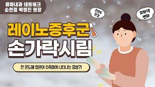 손발 차고 저린데 하얗게 변한다면? 레이노증후군이란!