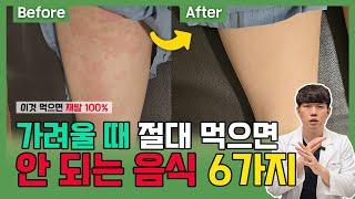 염증 100% 재발하는 피부질환 최악의 음식 6가지(아토피, 두드러기, 습진, 건선, 한포진..)