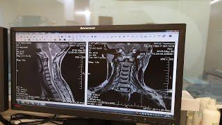 Как проходит мрт шейного отдела позвоночника. НДЦ Балашиха-Королёв-Щёлково.