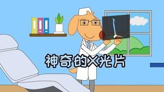 #科技学 神奇的X光片 #医疗科技