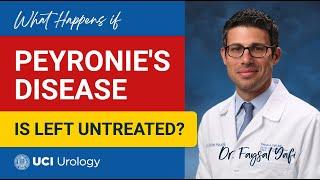 What Happens if Peyronie's Disease is Left Untreated? by Dr. Faysal A. Yafi - UCI Urology