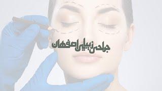 طراحی سایت پزشکی خدماتی جراحی زیبایی اصفهان توسط تفکر برتر