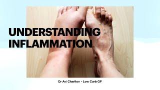 Understanding inflammation