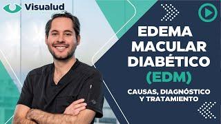 Edema Macular Diabético | Causas, diagnóstico y tratamiento con el Dr. Rodrigo Lechuga