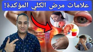 انتبه..10 علامات خطيره تدل على أمراض الكلي فشل الكلي/ لحماية الكلى من الأمراض وتراكم السموم