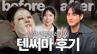 텐써마 꼭 시키세요,, 남자친구 600샷 내돈내산 후기 (feat. 써마지 저렴이)