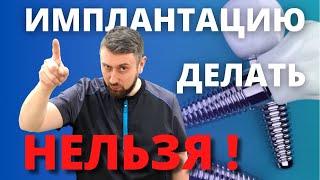 Противопоказания к  имплантам. Противопоказания к имплантации зубов.