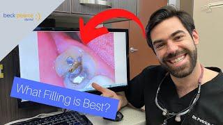 What Dental Filling is Best in 2021