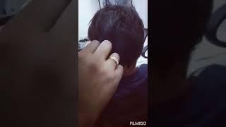 Fitting of Hearing Aid Earmould at THE BEST SPEECH THERAPY AND HEARING AID CENTRE MUZAFFARPUR