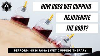 Performing Hijama (Wet Cupping Therapy) for Chronic Pain!