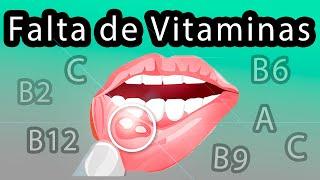 Esto sucede cuando te faltan vitaminas 8 señales de falta de vitaminas y minerales