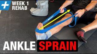 Ankle Sprain Rehab: What My Week 1 Looks Like