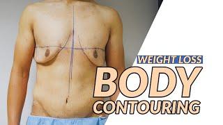 Body Contouring with Dr.Dadvand