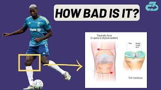 Expert Explains Paul Pogba Injury (meniscus tear) & Timeline Scenarios