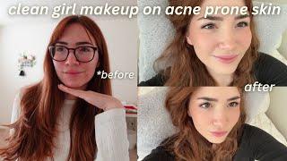 glowy clean girl makeup on acne prone skin | tips & tricks from my everyday makeup routine‍️