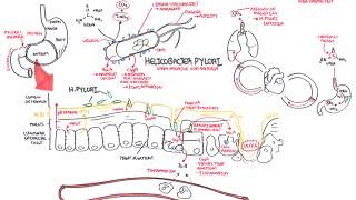 Microbiology - Helicobacter Pylori (Ulcer)