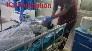 ICU Intubation' How to inubate critical patient in ICU