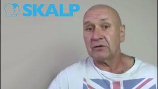 Scalp Micropigmentation Testimonial by Skalp® SMP review