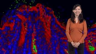 Julie Huang (Stanford U.): H. pylori finds its home