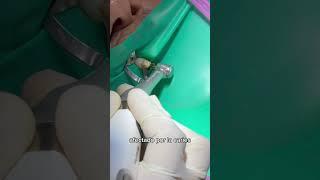 Paso a Paso de una Endodoncia  | Dra. Rosario Napa