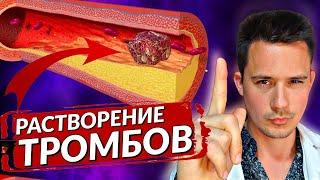 Тромбы | Растворение тромбов | Лекарство от тромбов