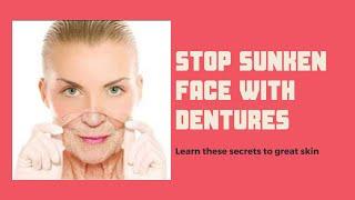 Stop sunken face with dentures, secrets to get rid of laugh lines