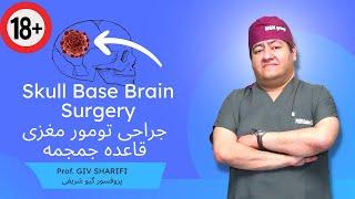 جراحی قاعده جمجمه - Skull Base Brain Surgery