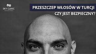 Pojechał do Turcji na przeszczep włosów. ŹLE SIĘ TO SKOŃCZYŁO