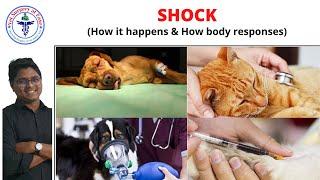 Shock | General Surgery | Lecture 04