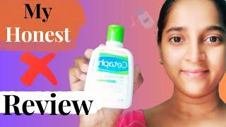 Galderma Cetaphil Moisturising Lotion honest review by PR The Explorer || Cetaphil Product Review